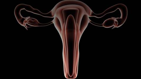 Educational Webinar - Diagnosis of Abnormal Uterine Bleeding - Dr. Steven R. Goldstein